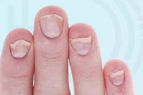 8078b2_7ca38ff5e4874c7da92e85518bef66ef~mv2